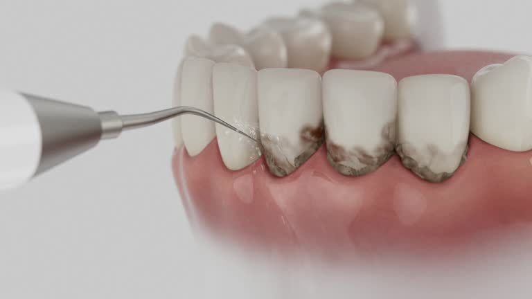 Trusted Tooth Extraction service in York, SC - Dentist Open Now